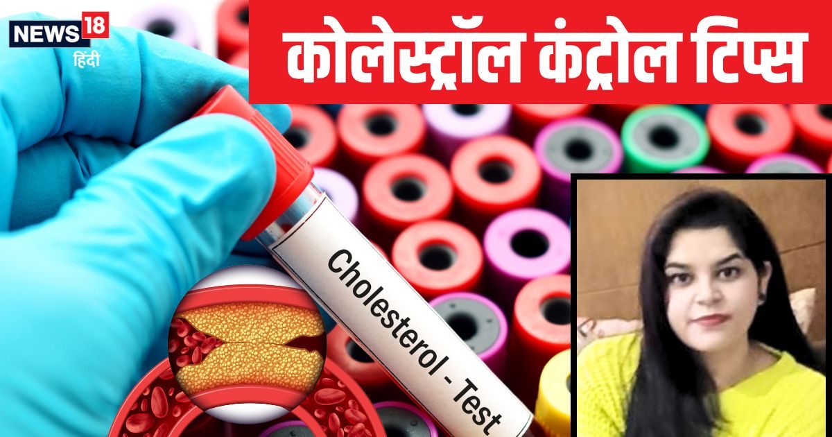 Daily Eat these 5 fruits Mango Apple Grapes Banana to Control Cholesterol | Do not stop blood circulation somewhere, start eating from today itself, these 5 fruits, blood will flow without interruption